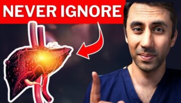 You Won’t Believe These Common Symptoms of Liver Enlargement